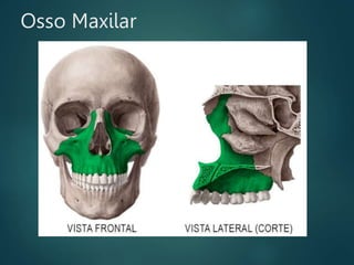 Osso Maxilar
 