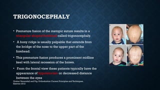 CRANIOFACIAL ANOMALIES.pptx orthodontics and dentofacial orthopedics | PPTX