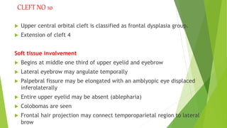 Craniofacial clefts part 2 [Autosaved]_124225.pptx