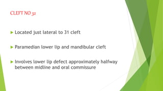 Craniofacial clefts part 2 [Autosaved]_124225.pptx