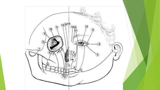 Craniofacial clefts part 2 [Autosaved]_124225.pptx