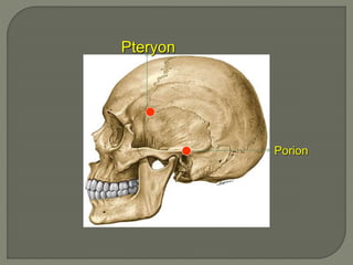 Porion
Pteryon
 