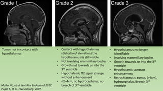 Tumor not in contact with
hypothalamus
• Contact with hypothalamus
(distortion/ elevation) the
hypothalamus is still visible
• Not involving mammillary bodies
• Growth not towards or into the
3rd ventricle
• Hypothalamic T2 signal change
without enhancement
• <2–4cm, no hydrocephalus, no
breech of 3rd ventricle
• Hypothalamus no longer
identifiable
• Involving mammillary bodies
• Growth towards or into the 3rd
ventricle
• Hypothalamic contrast
enhancement
• Retrochiasmatic tumor, (>4cm),
hydrocephalus, breech 3rd
ventricleMuller HL, et al. Nat Rev Endocrinol 2017.
Puget S, et al. J Neurosurg. 2007.
 