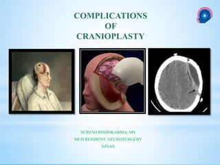 cka
SURESH BISHOKARMA, MS
MCH RESIDENT, NEUROSURGERY
NINAS
COMPLICATIONS
OF
CRANIOPLASTY
 