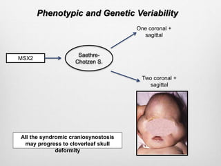 Phenotypic and Genetic Veriability
MSX2
Saethre-
Chotzen S.
One coronal +
sagittal
Two coronal +
sagittal
All the syndromic craniosynostosis
may progress to cloverleaf skull
deformity
 