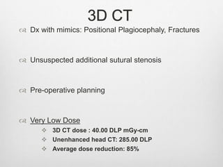 3D CT
 Dx with mimics: Positional Plagiocephaly, Fractures
 Unsuspected additional sutural stenosis
 Pre-operative planning
 Very Low Dose
 3D CT dose : 40.00 DLP mGy-cm
 Unenhanced head CT: 285.00 DLP
 Average dose reduction: 85%
 