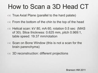 How to Scan a 3D Head CT
Branson HM 2011
 True Axial Plane (parallel to the hard palate)
 From the bottom of the chin to the top of the head
 Helical scan: kV 80, mA 60, rotation 0.5 sec (MAS
of 30). Slice thickness: 0.625 mm, pitch 0.969:1,
table speed: 19.37 mm/rotation
 Scan on Bone Window (this is not a scan for the
brain parenchyma)
 3D reconstruction: different projections
 