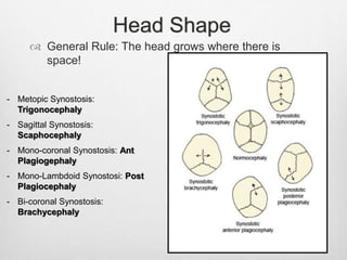 Head Shape
 General Rule: The head grows where there is
space!
- Metopic Synostosis:
Trigonocephaly
- Sagittal Synostosis:
Scaphocephaly
- Mono-coronal Synostosis: Ant
Plagiogephaly
- Mono-Lambdoid Synostosi: Post
Plagiocephaly
- Bi-coronal Synostosis:
Brachycephaly
 