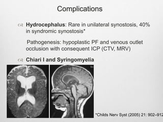 Complications
 Hydrocephalus: Rare in unilateral synostosis, 40%
in syndromic synostosis*
Pathogenesis: hypoplastic PF and venous outlet
occlusion with consequent ICP (CTV, MRV)
 Chiari I and Syringomyelia
*Childs Nerv Syst (2005) 21: 902–912
 