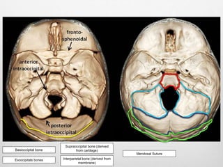 Basioccipital bone
Exoccipitals bones
Supraoccipital bone (derived
from cartilage)
Interparietal bone (derived from
membrane)
Mendosal Suture
 