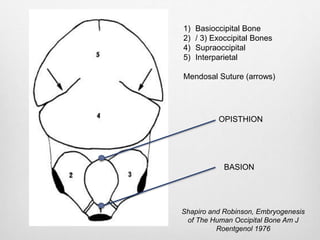 Shapiro and Robinson, Embryogenesis
of The Human Occipital Bone Am J
Roentgenol 1976
1) Basioccipital Bone
2) / 3) Exoccipital Bones
4) Supraoccipital
5) Interparietal
Mendosal Suture (arrows)
OPISTHION
BASION
 