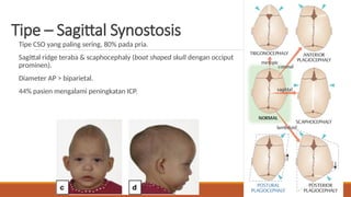 Sadgital Ridge Craniosynostosis treatment and diagnostic.pptx