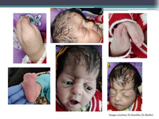 Images courtesy: Dr.Sumitha, Dr.Maithri
 