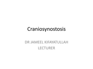 Craniosynostosis
DR JAMEEL KIFAYATULLAH
LECTURER
 