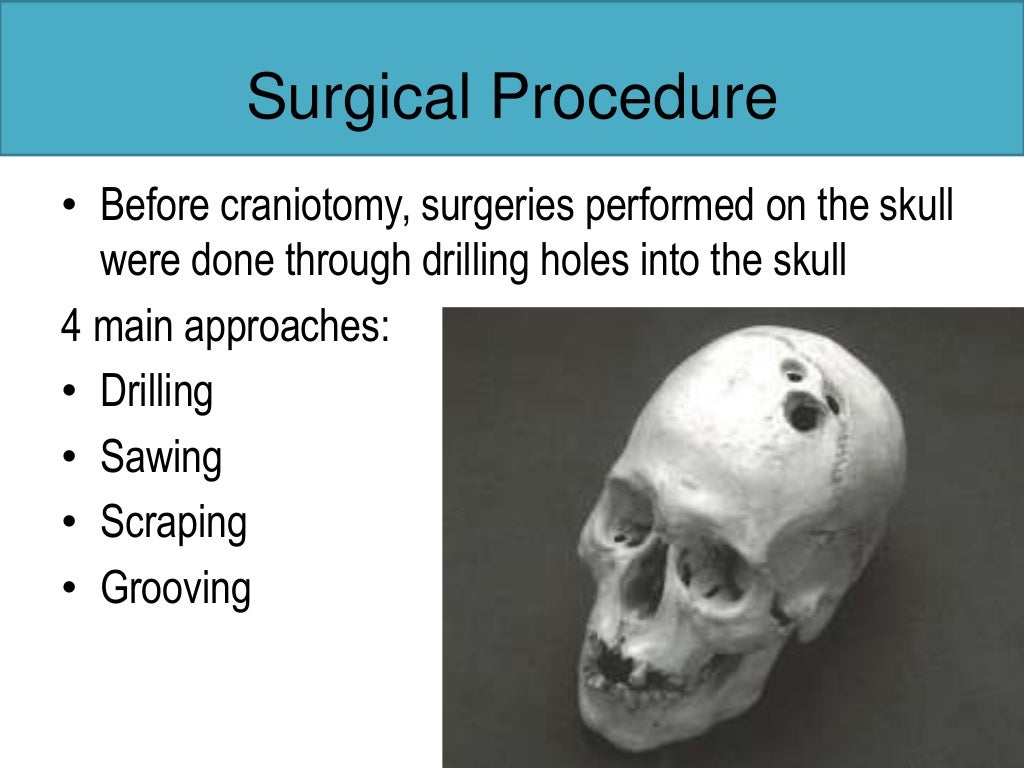 Craniotomy
