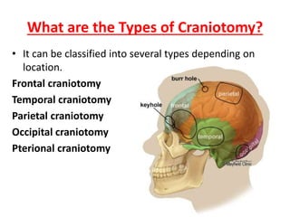 Craniotomy.pptx
