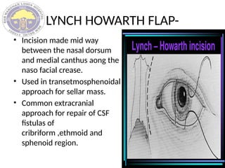 CRANIOTOMY FLAPS ,INCISION AND CLOSURE.pptx