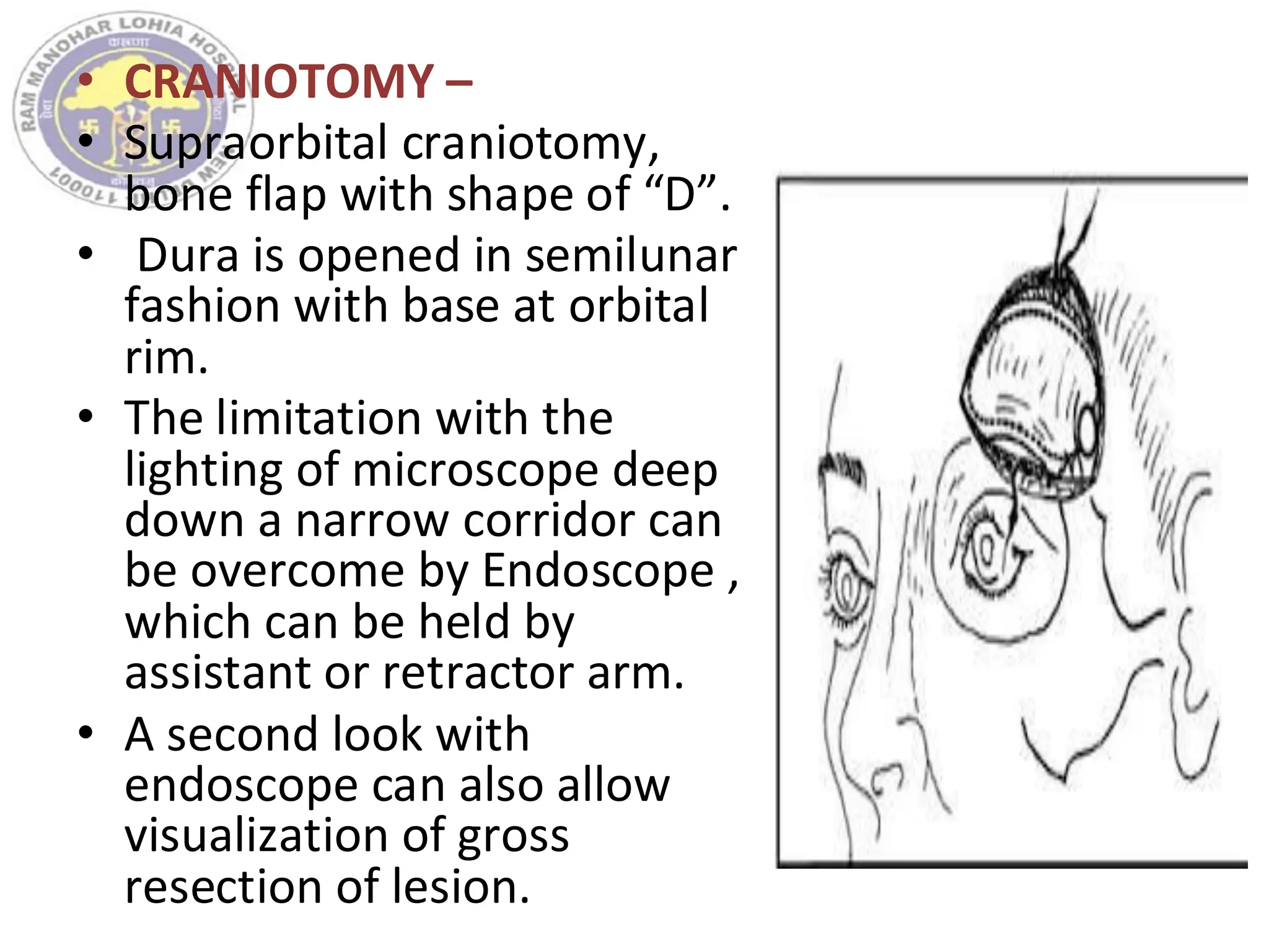 • CRANIOTOMY –
• Supraorbital craniotomy,
bone flap with shape of “D”.
• Dura is opened in semilunar
fashion with base at orbital
rim.
• The limitation with the
lighting of microscope deep
down a narrow corridor can
be overcome by Endoscope ,
which can be held by
assistant or retractor arm.
• A second look with
endoscope can also allow
visualization of gross
resection of lesion.
 