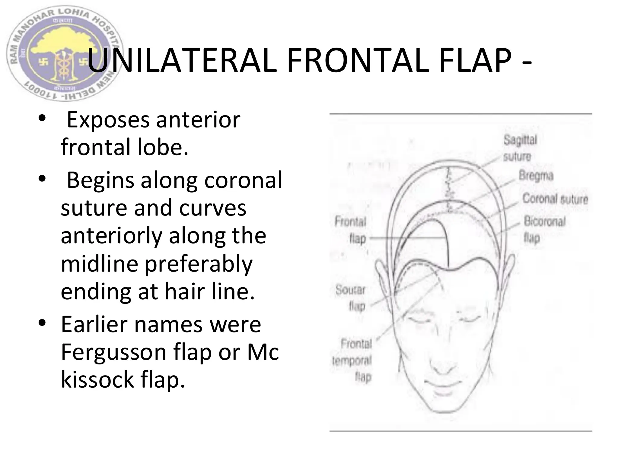 UNILATERAL FRONTAL FLAP -
• Exposes anterior
frontal lobe.
• Begins along coronal
suture and curves
anteriorly along the
midline preferably
ending at hair line.
• Earlier names were
Fergusson flap or Mc
kissock flap.
 