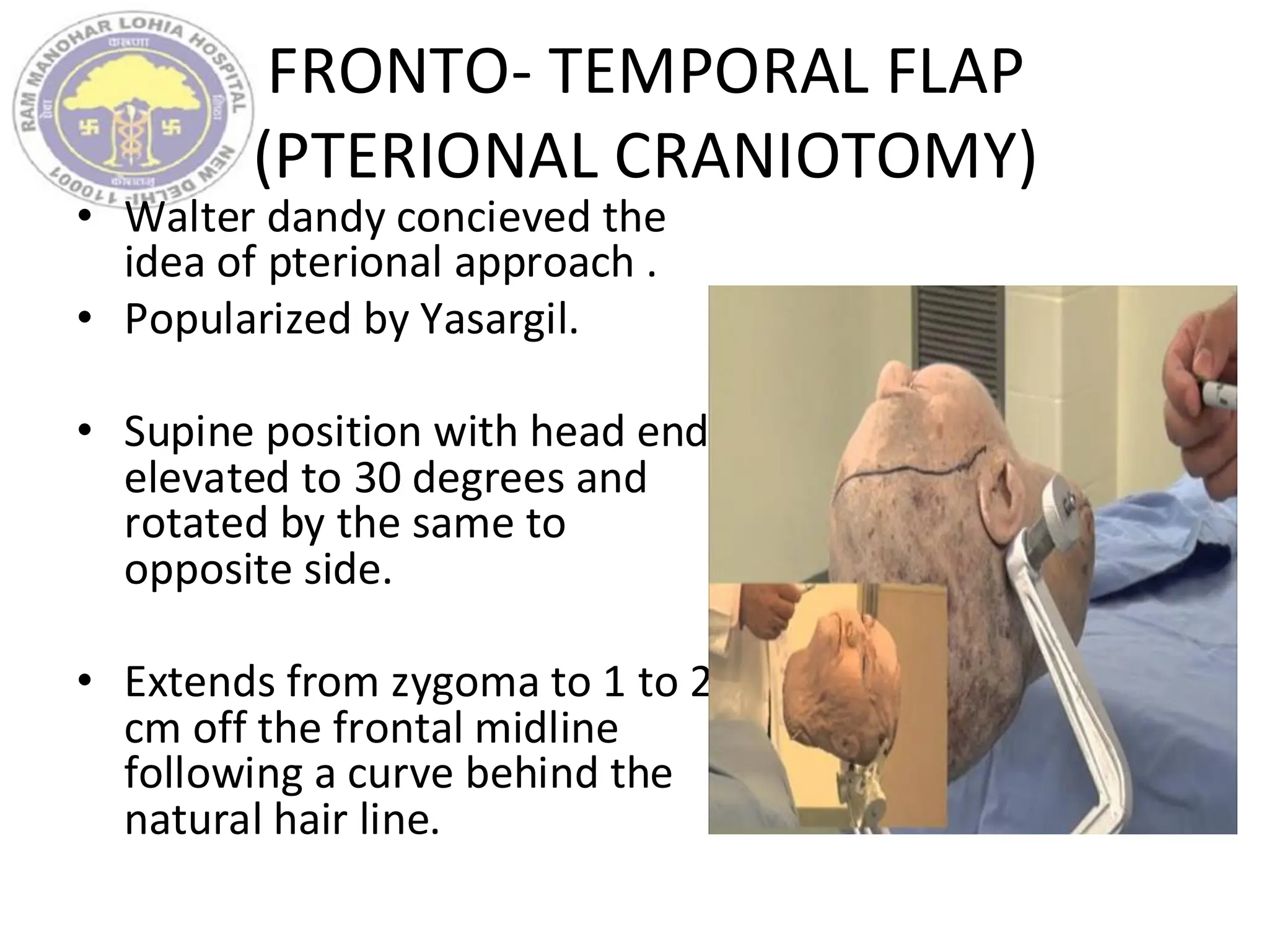 FRONTO- TEMPORAL FLAP
(PTERIONAL CRANIOTOMY)
• Walter dandy concieved the
idea of pterional approach .
• Popularized by Yasargil.
• Supine position with head end
elevated to 30 degrees and
rotated by the same to
opposite side.
• Extends from zygoma to 1 to 2
cm off the frontal midline
following a curve behind the
natural hair line.
 