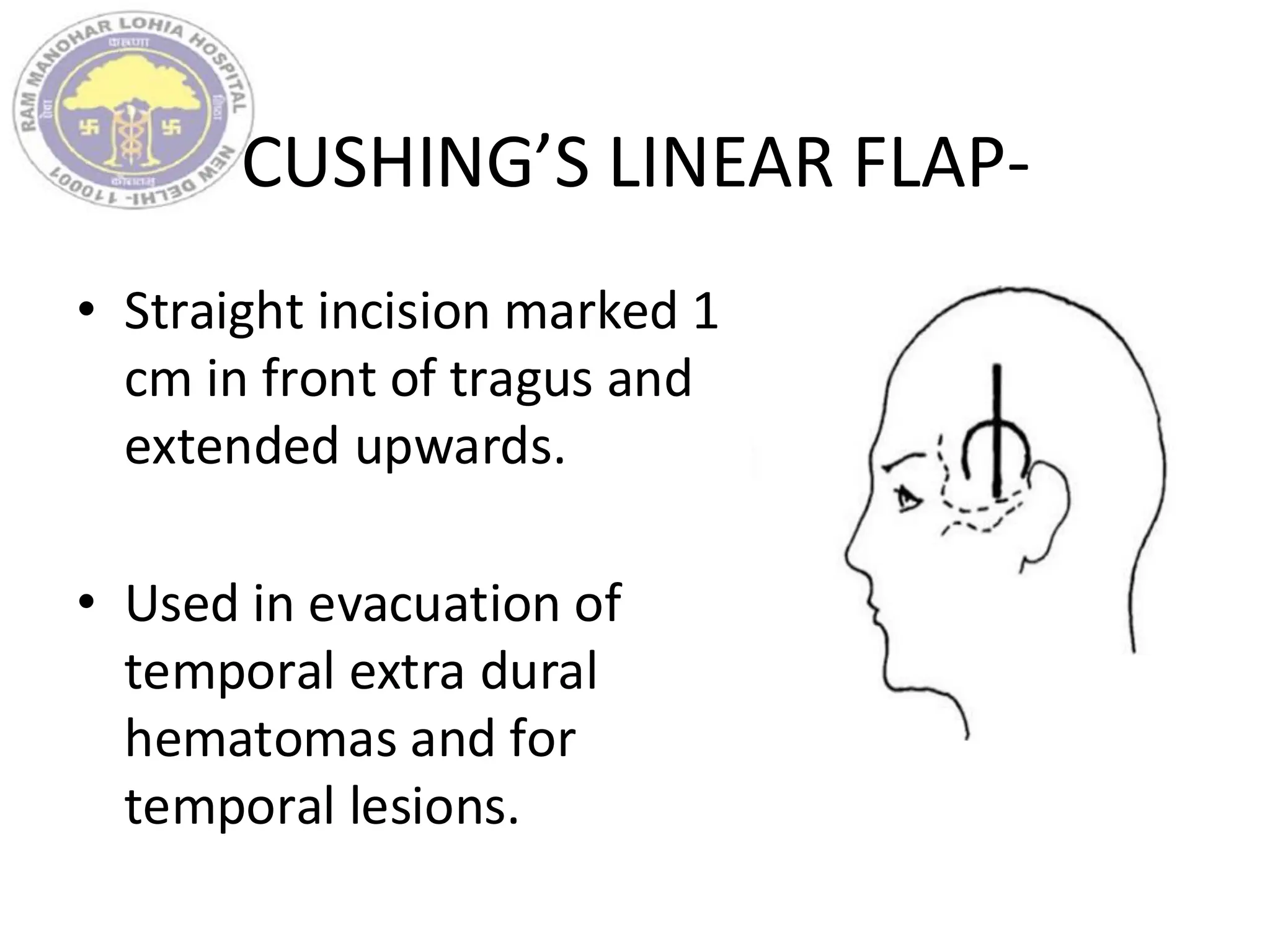 CUSHING’S LINEAR FLAP-
• Straight incision marked 1
cm in front of tragus and
extended upwards.
• Used in evacuation of
temporal extra dural
hematomas and for
temporal lesions.
 
