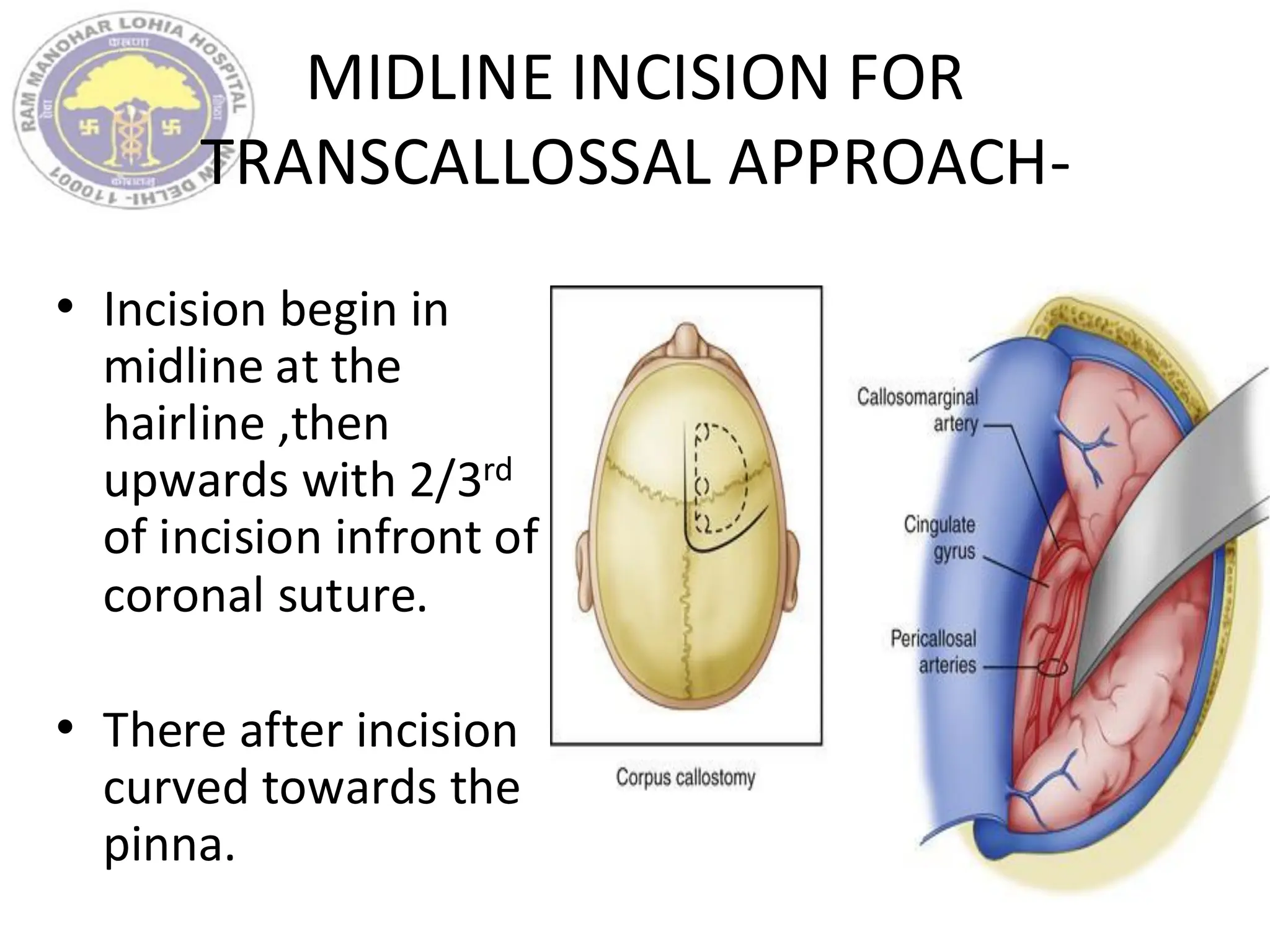 MIDLINE INCISION FOR
TRANSCALLOSSAL APPROACH-
• Incision begin in
midline at the
hairline ,then
upwards with 2/3rd
of incision infront of
coronal suture.
• There after incision
curved towards the
pinna.
 