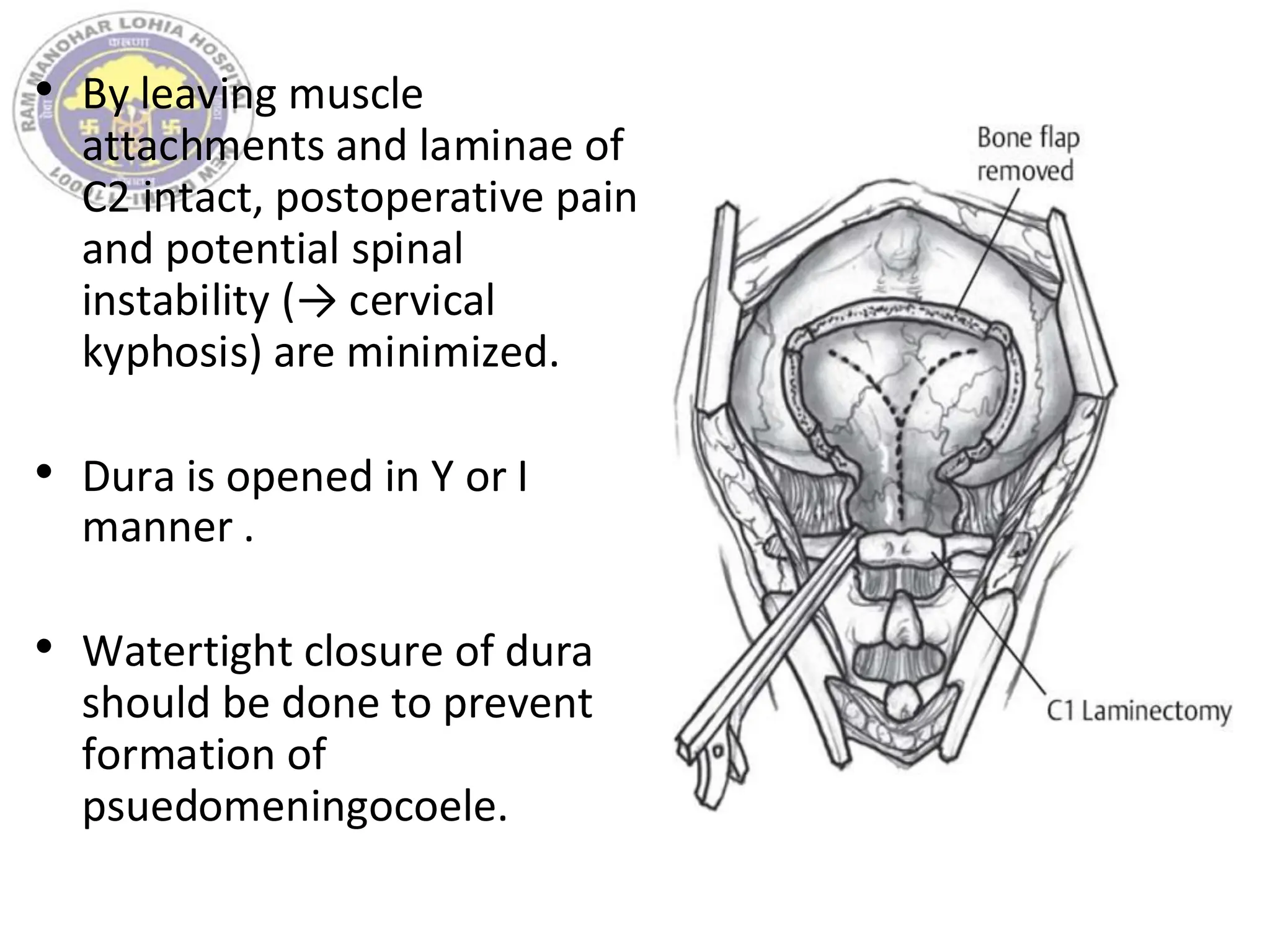 • By leaving muscle
attachments and laminae of
C2 intact, postoperative pain
and potential spinal
instability (→ cervical
kyphosis) are minimized.
• Dura is opened in Y or I
manner .
• Watertight closure of dura
should be done to prevent
formation of
psuedomeningocoele.
 