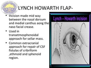 LYNCH HOWARTH FLAP-
• Incision made mid way
between the nasal dorsum
and medial canthus aong the
naso facial crease.
• Used in
transetmosphenoidal
approach for sellar mass.
• Common extracranial
approach for repair of CSF
fistulas of cribriform
,ethmoid and sphenoid
region.
 