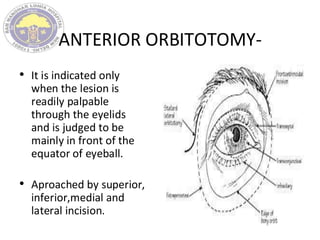 ANTERIOR ORBITOTOMY-
• It is indicated only
when the lesion is
readily palpable
through the eyelids
and is judged to be
mainly in front of the
equator of eyeball.
• Aproached by superior,
inferior,medial and
lateral incision.
 