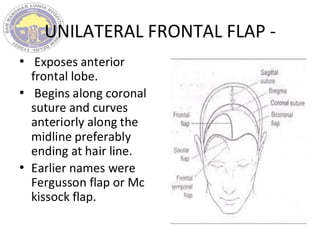 UNILATERAL FRONTAL FLAP -
• Exposes anterior
frontal lobe.
• Begins along coronal
suture and curves
anteriorly along the
midline preferably
ending at hair line.
• Earlier names were
Fergusson flap or Mc
kissock flap.
 