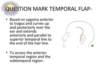 QUESTION MARK TEMPORAL FLAP-
• Based on zygoma anterior
to tragus and curves up
and posteriorly over the
ear and extends
anteriorly and parallel to
superior temporal line to
the end of the hair line.
• To access the anterior
temporal region and the
subtemporal region.
 