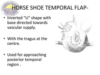HORSE SHOE TEMPORAL FLAP-
• Inverted “U” shape with
base directed towards
vascular supply.
• With the tragus at the
centre.
• Used for approaching
posterior temporal
region .
 