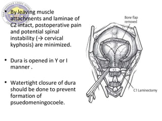 • By leaving muscle
attachments and laminae of
C2 intact, postoperative pain
and potential spinal
instability (→ cervical
kyphosis) are minimized.
• Dura is opened in Y or I
manner .
• Watertight closure of dura
should be done to prevent
formation of
psuedomeningocoele.
 
