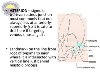 • ASTERION – sigmoid-
transverse sinus junction
most commonly (but not
always) lies at anteriorly-
superiorly (so it is safe to
drill here if targeting
venous sinus angle) .
• Landmark- on the line from
root of zygoma to inion
where it is intersected with
vertical line just behind
mastoid process.
 
