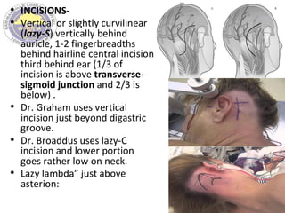 • INCISIONS-
• Vertical or slightly curvilinear
(lazy-S) vertically behind
auricle, 1-2 fingerbreadths
behind hairline central incision
third behind ear (1/3 of
incision is above transverse-
sigmoid junction and 2/3 is
below) .
• Dr. Graham uses vertical
incision just beyond digastric
groove.
• Dr. Broaddus uses lazy-C
incision and lower portion
goes rather low on neck.
• Lazy lambda” just above
asterion:
 