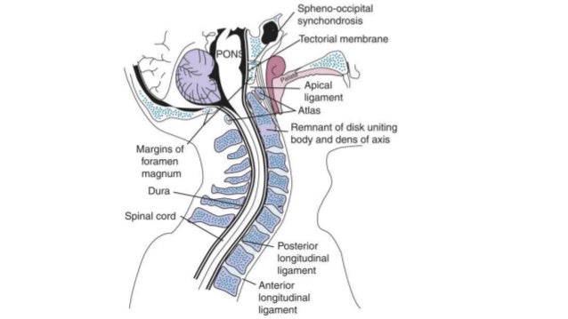 fluid how leak cerebrospinal ANOMALIES Craniovertebral JUNCTION fluid how leak cerebrospinal ANOMALIES Craniovertebral JUNCTION