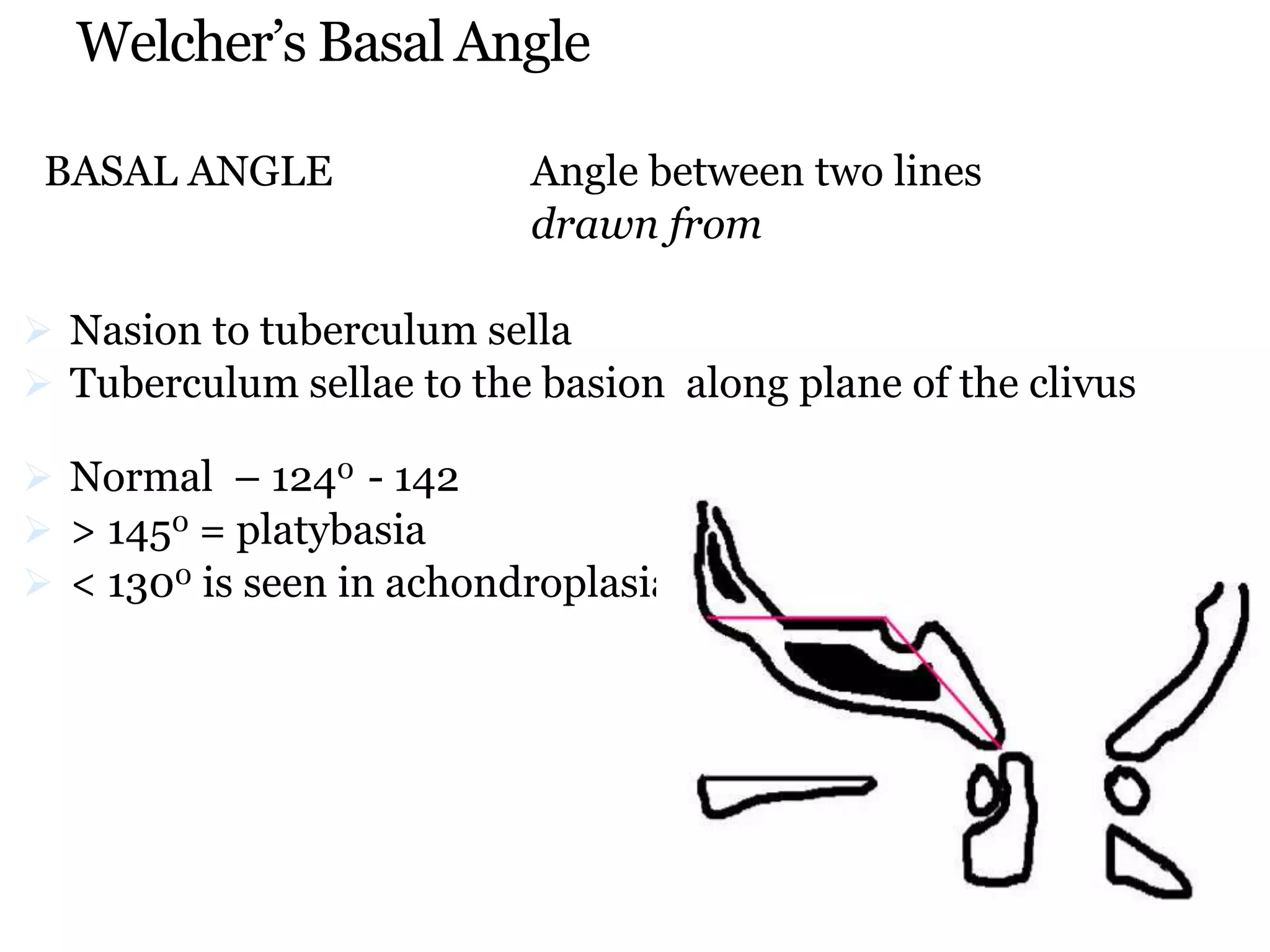 Welcher’s Basal Angle
BASAL ANGLE Angle between two lines
drawn from
 Nasion to tuberculum sella
 Tuberculum sellae to the basion along plane of the clivus
 Normal – 1240 - 142
 > 1450 = platybasia
 < 1300 is seen in achondroplasiaaaasdaaaaaaaaa
 
