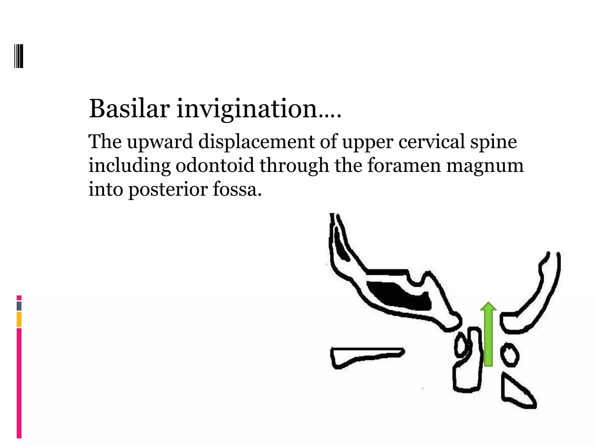 Basilar invigination….
The upward displacement of upper cervical spine
including odontoid through the foramen magnum
into posterior fossa.
 