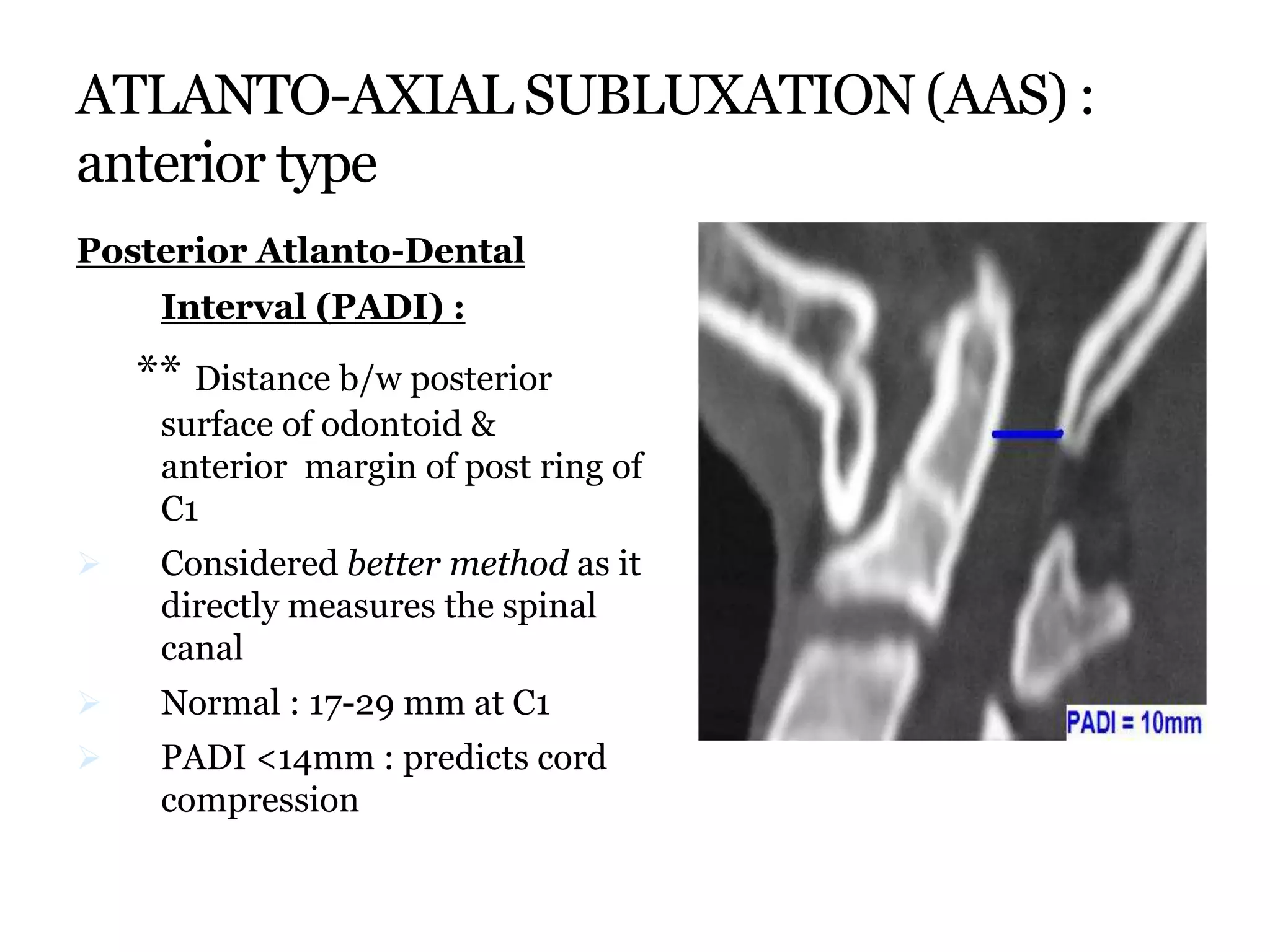ATLANTO-AXIAL SUBLUXATION (AAS) :
anterior type
Posterior Atlanto-Dental
Interval (PADI) :
** Distance b/w posterior
surface of odontoid &
anterior margin of post ring of
C1
 Considered better method as it
directly measures the spinal
canal
 Normal : 17-29 mm at C1
 PADI <14mm : predicts cord
compression
 
