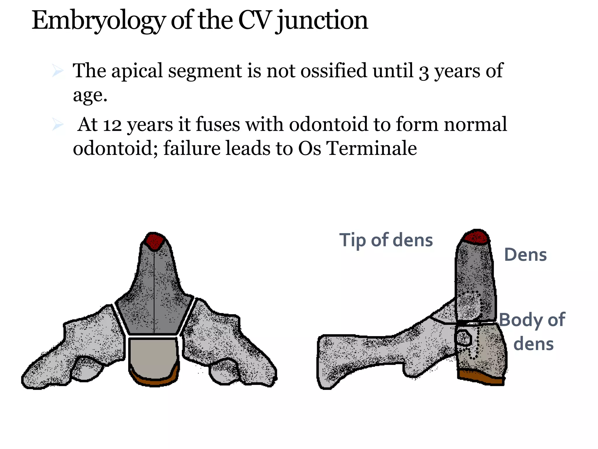 Embryology of the CV junction
 The apical segment is not ossified until 3 years of
age.
 At 12 years it fuses with odontoid to form normal
odontoid; failure leads to Os Terminale
Tip of dens
Body of
dens
Dens
 