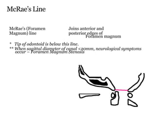 McRae’s Line
McRae's (Foramen Joins anterior and
Magnum) line posterior edges of
Foramen magnum
* Tip of odontoid is below this line.
** When sagittal diameter of canal <20mm, neurological symptoms
occur – Foramen Magnum Stenosis
 