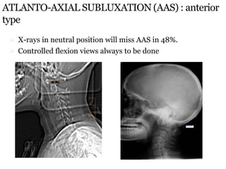 ATLANTO-AXIAL SUBLUXATION (AAS) : anterior
type
 X-rays in neutral position will miss AAS in 48%.
 Controlled flexion views always to be done
 