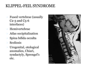 KLIPPEL-FEIL SYNDROME
 Fused vertebrae (usually
C2-3 and C5-6
interfaces)
 Hemivertebrae
 Atlas occipitalization
 Spina bifida occulta
 Scoliosis
 Urogenital, otological
anomalies, Chiari,
syndactyly, Sprengel’s
etc.
 