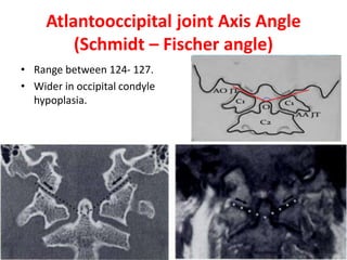 Atlantooccipital joint Axis Angle
(Schmidt – Fischer angle)
• Range between 124- 127.
• Wider in occipital condyle
hypoplasia.
 