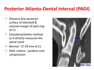 Posterior Atlanto-Dental Interval (PADI)
• Distance b/w posterior
surface of odontoid &
anterior margin of post ring
of C1
• Considered better method
as it directly measures the
spinal canal
• Normal : 17-29 mm at C1
• PADI <14mm : predicts cord
compression
 