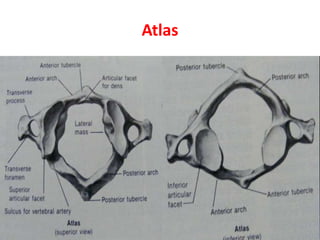 Atlas
 