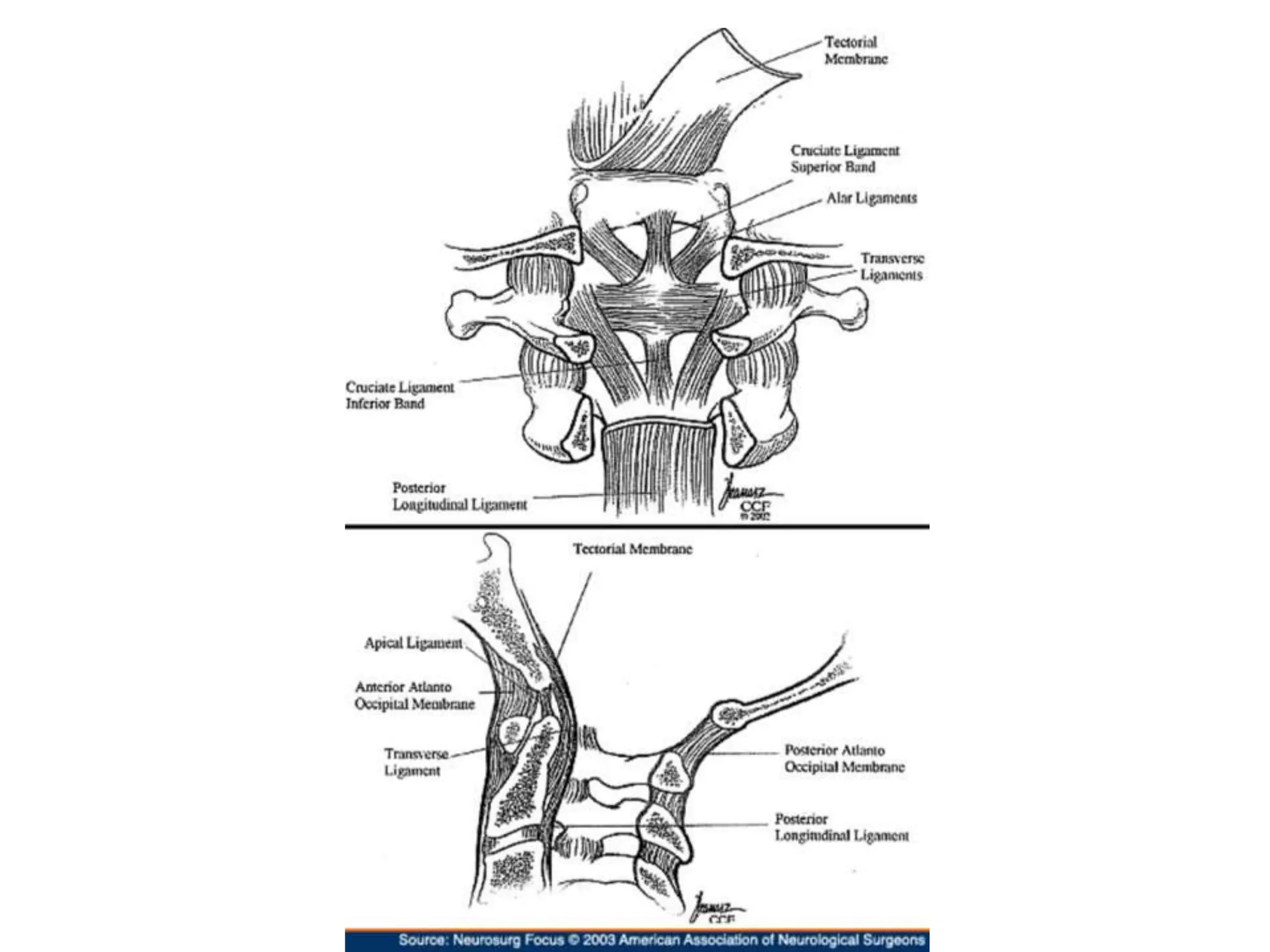 Craniovertebral junction cvj embryology | PPTX