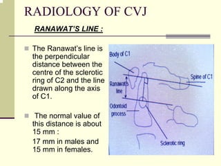 RADIOLOGY OF CVJ
RANAWAT’S LINE :
The Ranawat’s line is
the perpendicular
distance between the
centre of the sclerotic
ring of C2 and the line
drawn along the axis
of C1.
The normal value of
this distance is about
15 mm :
17 mm in males and
15 mm in females.
 