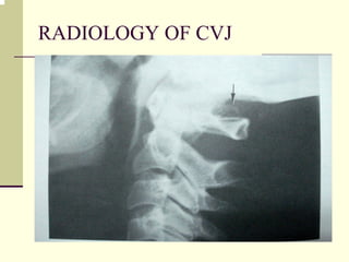 RADIOLOGY OF CVJ
 