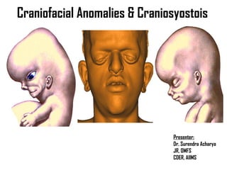 Craniofacial Anomalies & Craniosyostois
Presenter:
Dr. Surendra Acharya
JR, OMFS
CDER, AIIMS
 